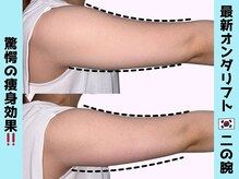 カンナムビューティー 福岡天神店/オンダリフト/福岡/ララピール