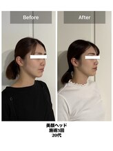 コンクパール(CONCH PEARL.)/美顔ヘッド