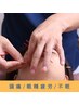 【頭痛・眼精疲労に】頭と目をまとめてリセット★水素×矯正×頭皮鍼 60分