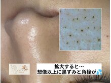 クリアホワイト(Clear White)/スコープで見た汚れ