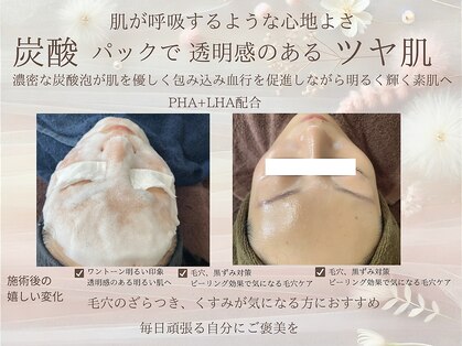 アムール(l'amour)の写真