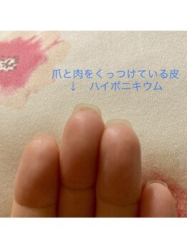 桃の木 吉祥寺店/爪の裏側を見てみて下さい