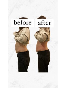 ビーアイリー(Be irie)/痩身エステ直後の変化