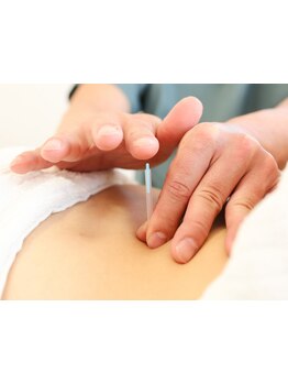 鍼灸施術を受けたい