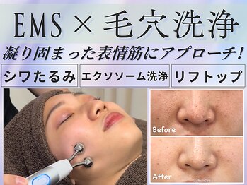 ベル アージュ/EMS×毛穴洗浄