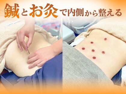 はっちの整骨院の写真