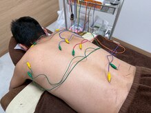 はりの門 神谷町 虎ノ門/ぎっくり後の引きずる腰痛に