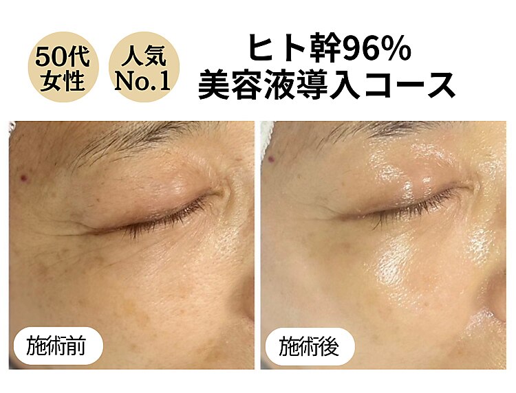 グラツィア 福岡天神地下街店｜ホットペッパービューティー