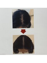 イーズ/リバイタ グランツリー武蔵小杉店/【ケース9】50代女性