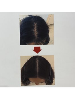 イーズ/リバイタ グランツリー武蔵小杉店/【ケース9】50代女性