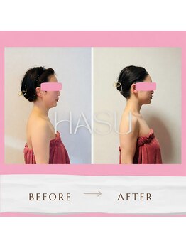 蓮(HASU)の写真/小顔と美姿勢は土台から変わる
