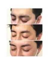 アイビー 神保町店(i.b)/眉【before⇒after】６１