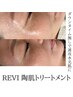 【剥離無し】REVI陶肌トリートメント/1ヶ月以内にご予約の方限定☆