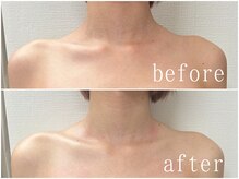 美人ヶ丘/小顔矯正,マッサージ,ヘッドスパ