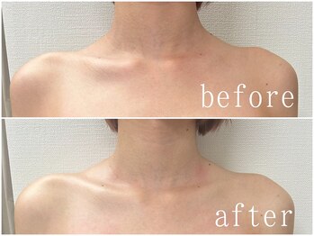 美人ヶ丘/小顔矯正,マッサージ,ヘッドスパ