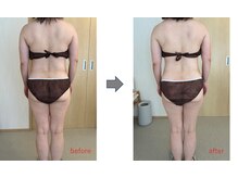 ルルラ(Rulula)/痩身ダイエット施術前後5