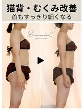 ディアメデル(Diamedel) BEFORE AFTER