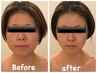 【小顔・お肌のハリUP】たった5分で劇的変化!ゼロジーフリー小顔フェイシャル