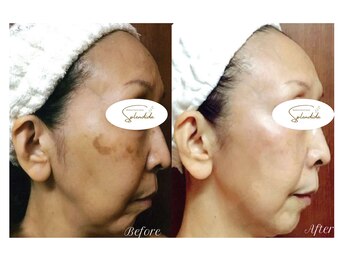 スプレンディダ(Splendida)