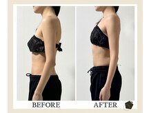 サンク(Cinq)/【整体＋骨盤矯正】姿勢改善