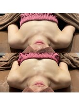 ロココ 錦糸町店(Rococo)/比較写真