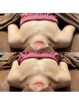 ロココ 錦糸町店(Rococo)/比較写真