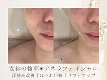 アネラボーテ(Anela Beaute)/女神の輪郭アネラフェイシャル