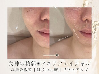 アネラボーテ(Anela Beaute)/女神の輪郭アネラフェイシャル