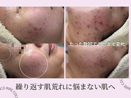ココリールの写真