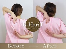 ビーハリット(B-HariT)/Before/After【六本木】