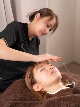 ベルヴェラ(Belvela)の写真/痛みの少ない鍼◎美容鍼灸の技術を活かして、身体の軸を整え巡りをスムーズに！男性も大歓迎◎