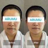 アルム コリア(ARUMU KOREA)