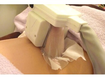 トータルビューティーサロン キララ(KIRARA)/冷却痩身