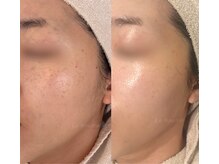 ルブドワール(Le Boudoir)/エンビロントリートメント