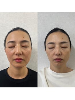 こうぞう整体院/美容鍼×筋膜リリース