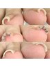 足の巻き爪が綺麗になる！巻き爪ケア+ワンカラージェル初回体験