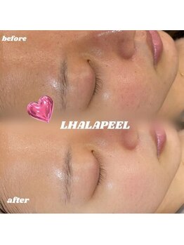 サニーラッシュ &nbsp;高蔵寺 志段味店(Sunny Lash)/ (ララピール)初回価格 6,500円