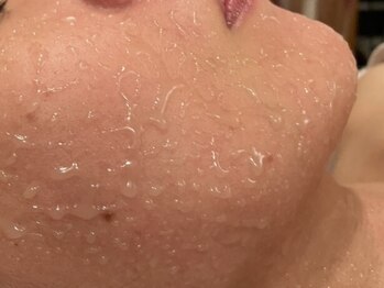 アンリール(ANRIRE)の写真/【毛穴汚れ・詰まり改善◎】毛穴ケアゼロジーフリー＋小顔フェイシャル