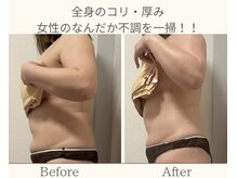 エステ大阪PON/全身大量発汗/セル&むくみ撃退！