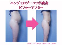 ソフィア ミューズ 目黒/目黒エンダモロジーで代謝促進