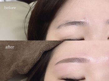 レーヴラグゼ(REVE LUXE)/before/after