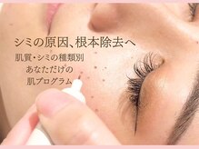 ジーニー(genie)