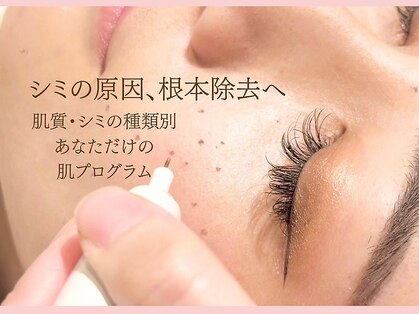 ジーニー(genie)の写真