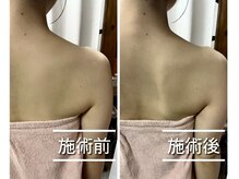 ファミリア整体院の雰囲気（肩こり肩甲骨はがし整体の症例実績【整体/肩こり/腰痛/千葉駅】）