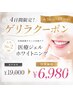 ★【緊急企画】4日間限定!歯科医提携ジェルホワイトニング¥19,000⇒¥6,980