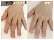 キレイテ 上野店/30代/4回目【ハンドケア上野】