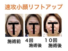 鍼灸サロンオランジュ 高槻富田院/