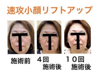 鍼灸サロンオランジュ 高槻富田院/
