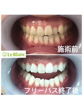 ルブラン 奈良店(Le Blanc)/黄ばみ諦めないで下さい！