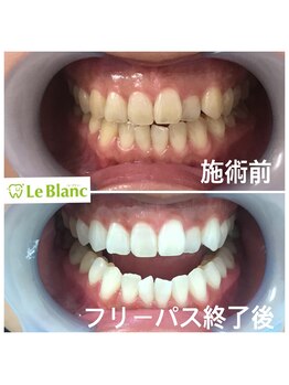 ルブラン 奈良店(Le Blanc)/黄ばみ諦めないで下さい！